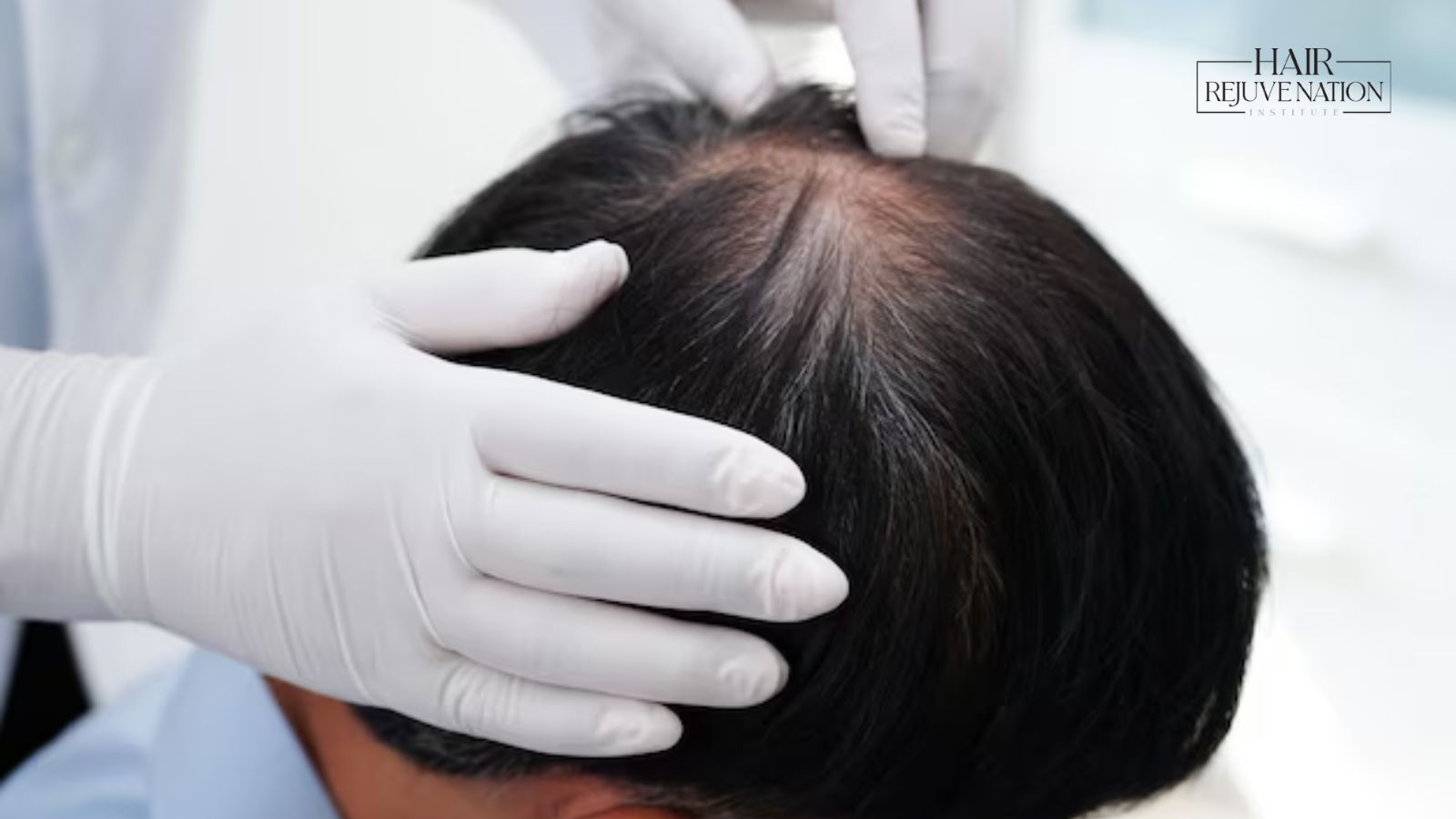 Scarring Alopecia: Understanding the Diagnosis and Treatment for Hair and Scalp Health